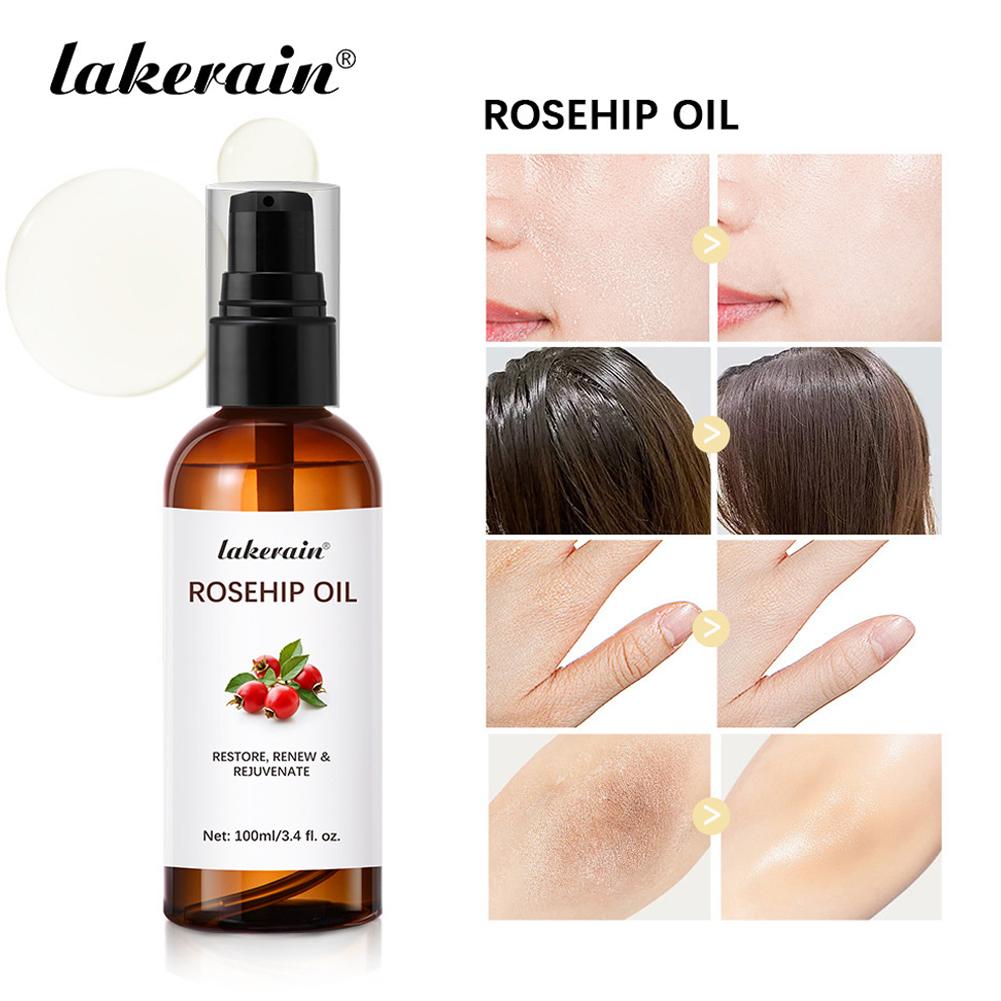 Rosehip Oil For Face & Skin Or - Cold Pressed Rose Hip review and price