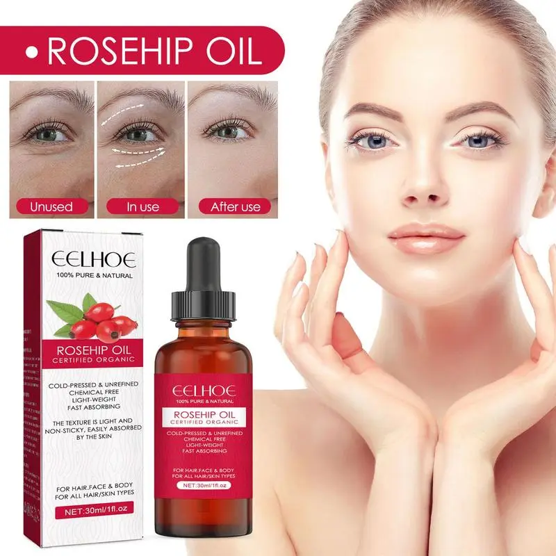 30ml Organic Rosehip Seed Oil  - Cold Pressed Rose Hip review and price